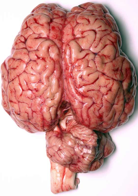 human brain diagram. Caption: human brain