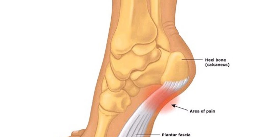 Cara Hilang Sakit Tumit Kaki Menyucuk Tanpa Guna Ubat 