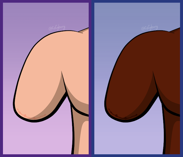 Two cartoony illustrations side by side of an above-elbow amputee's stump, The image on the left belonging to a white person, the one on the right belonging to a black person. on both, there is a small jagged line across the bottom of the stump. On the black stump, the line is a slightly darker tone than the rest of the skin, but only slightly. On the white stump, the line is also slightly darker with a slightly pinker hue. On both, the line, a thin incision scar, is very subtle and has faded with time.
