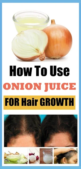 Why Onion Juice Is Extremely Beneficial For Hair Growth