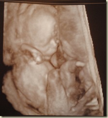 Ultrasound 2