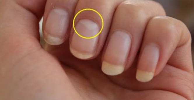 Do Not Have A Half-Moon Shape On Your Nails