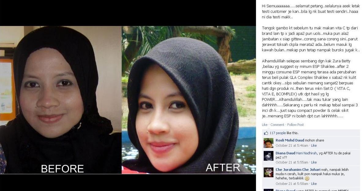 Testimoni ESP dan Set Kecantikan Shaklee : Bertambah Cun 