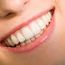 Thực hiện bọc sứ Titan giá bao nhiêu?