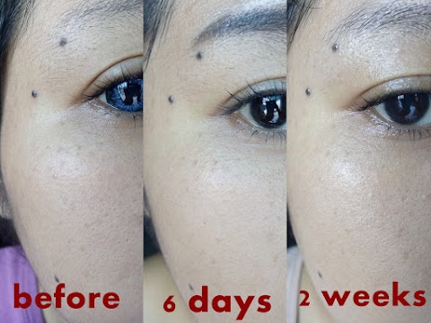 Garnier Vitamin C Serum Review Malaysia