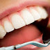 5 Food Causes Damage Teeth