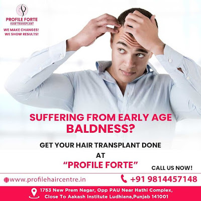 Sufferign From baldness Get Hair Transplant in Punjab