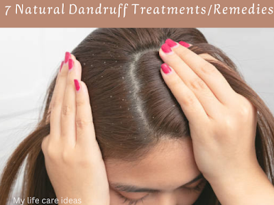 dandruff treatment/remedies