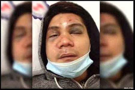 Vhong Navarro Binugbog CCTV Footage