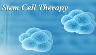 Advantages Of A Stem Cell Treatment Center