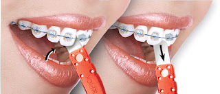 How to Floss Teeth with Braces?, Flossing with Braces, braces pain