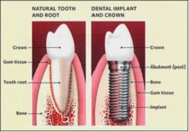 Cosmetic Dentistry Arizona