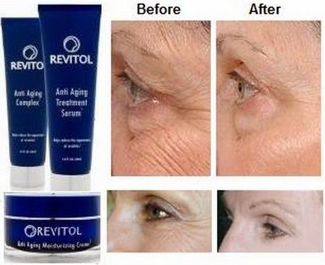 Revitol skin brightener cream reviews