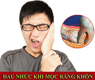 Độ nguy hiểm của răng khôn mọc lệch