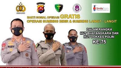 HUT Bhayangkara dan HUT Dokkes Polri ke-75, Polda Banten Gelar Bakti Kesehatan Operasi Bibir Sumbing GRATIS 
