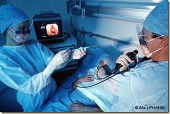 cancer de pulmon1