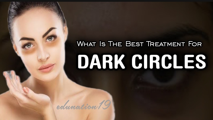 What is the Best Treatment for Dark Circles