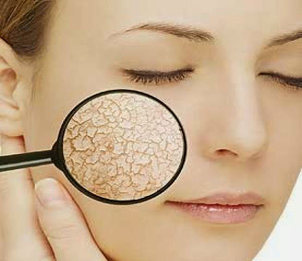 Home Remedies For Dry Skin in Winter