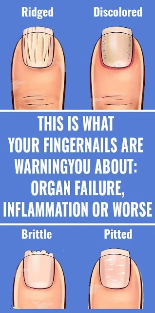 This is what your nails try to tell about your health