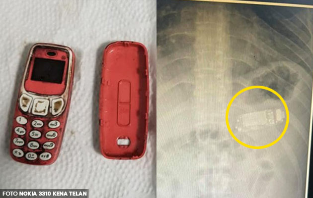 'Takut kantoi dengan bini ke?' - Lelaki telan telefon Nokia 3310