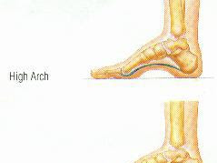 [Achevée! ] contoh telapak kaki bebek 248428-Contoh telapak kaki bebek