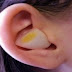 This Is What Happen When You Put Cut Up Onion Inside Your Ear - "Onion" The Amazing ′Cure-All′..