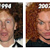 Carrot top before plastic surgery