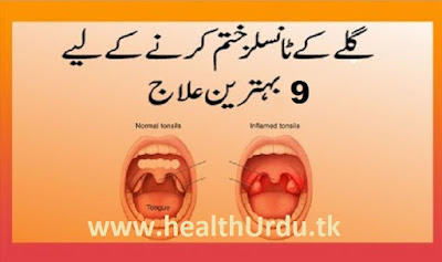 tonsillitis home remedies urdu