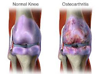 Dr-Saadia-Riaz-Rheumatologist