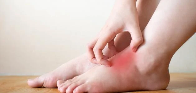 علاج التنميل في باطن القدم ببعض العلاجات المنزلية