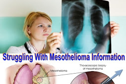 Struggling With Mesothelioma Information