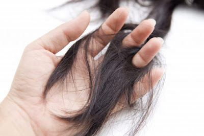 treatment of hair loss in men and women - pictures-photos-images