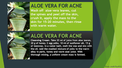 NATURAL ACNE TREATMENT