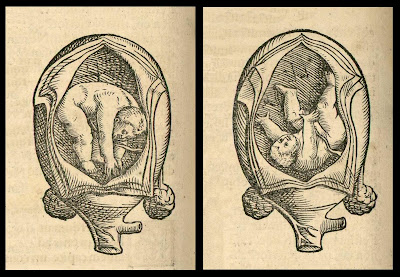 foetal positions - anatomical woodcut