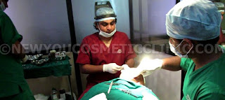 Hair Transplant in Bangalore Using Neograft