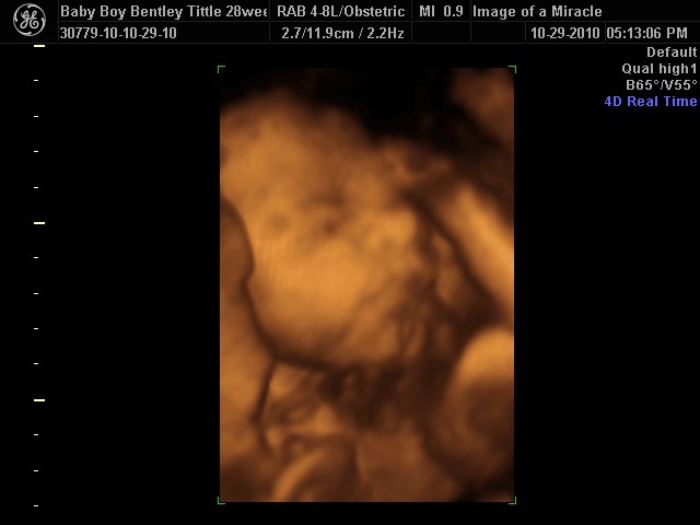 THE TITTLE FAMILY: 4D Ultrasound