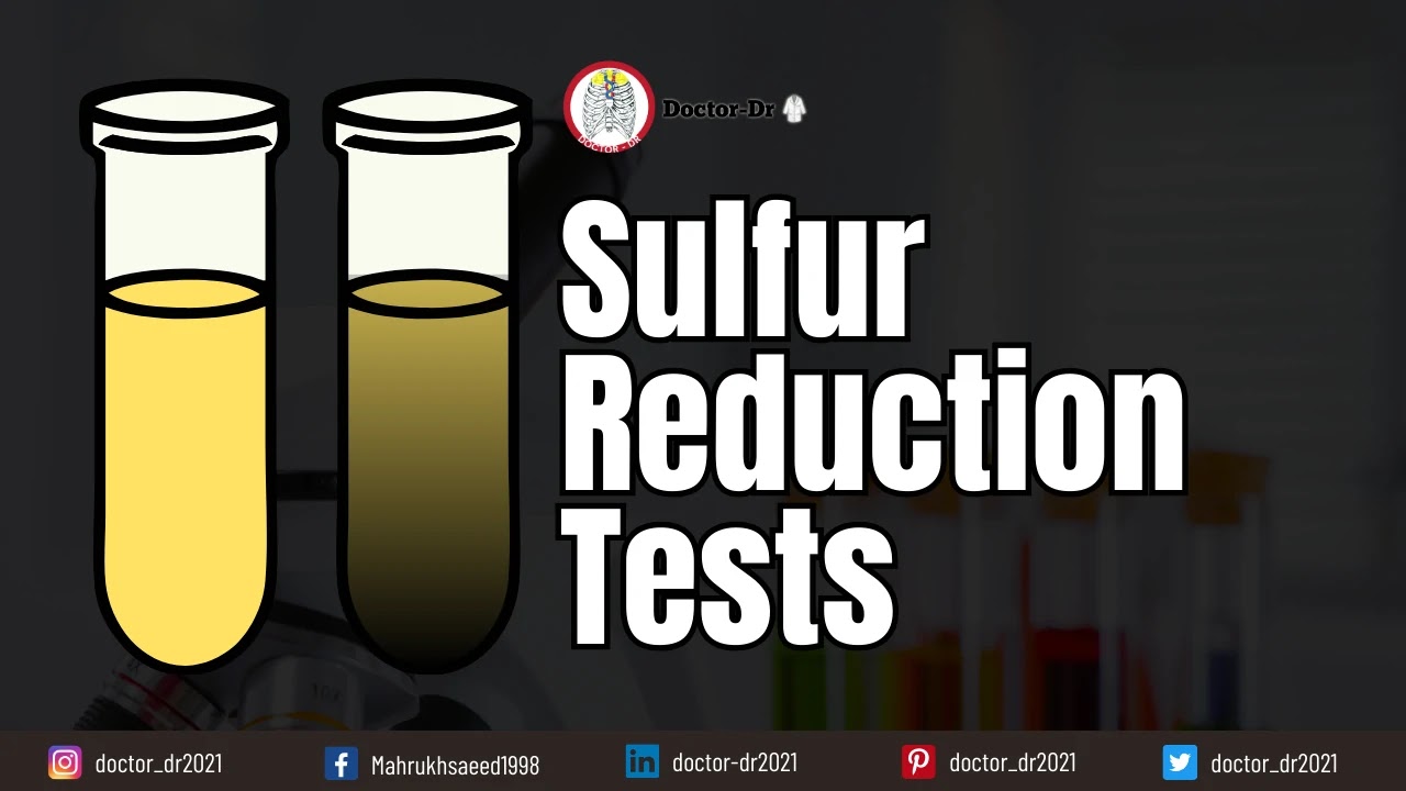 Sulfur Reduction Test: Principle, Procedure, Results, Uses