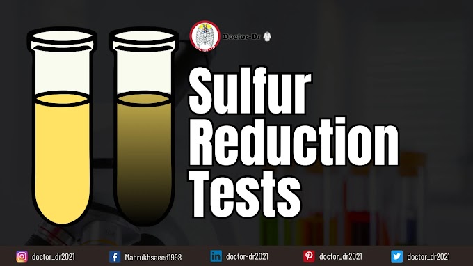 Sulfur Reduction Test: Principle, Procedure, Results, Uses