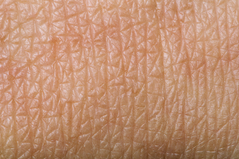 skin wrinkles from eating too much sugar