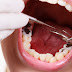 Phụ nữ mới sinh có nhổ răng được không? Tại sao?