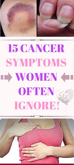 15 Cancer Symptoms Women Often Ignore