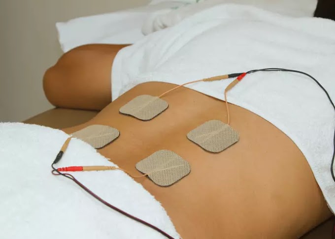 TENS (Transkutanöz Elektriksel Siniir Stimülasyonu) Nedir?