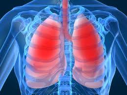 pengertian pneumonia - e-jurnal