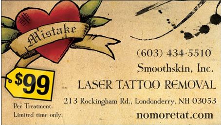 ... is per treatment come on down and show us your tattoo you want removed