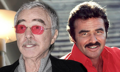 Burt Reynolds Plastic Surgery Before and After