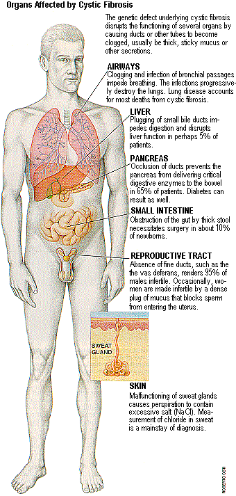 cystic fibrosis symptoms