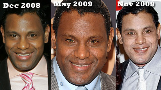 Sammy Sosa Skin Change