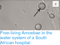 http://sciencythoughts.blogspot.co.uk/2015/02/free-living-amoebae-in-water-system-of.html