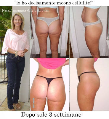 ridurre cellulite