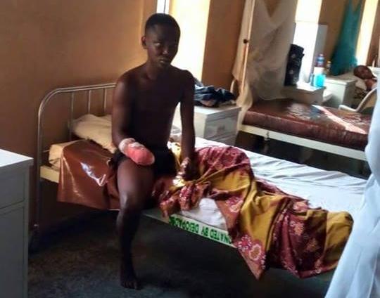 Graphic pics: Young boy's hand cut off as he tried stealing phone through window in Delta state